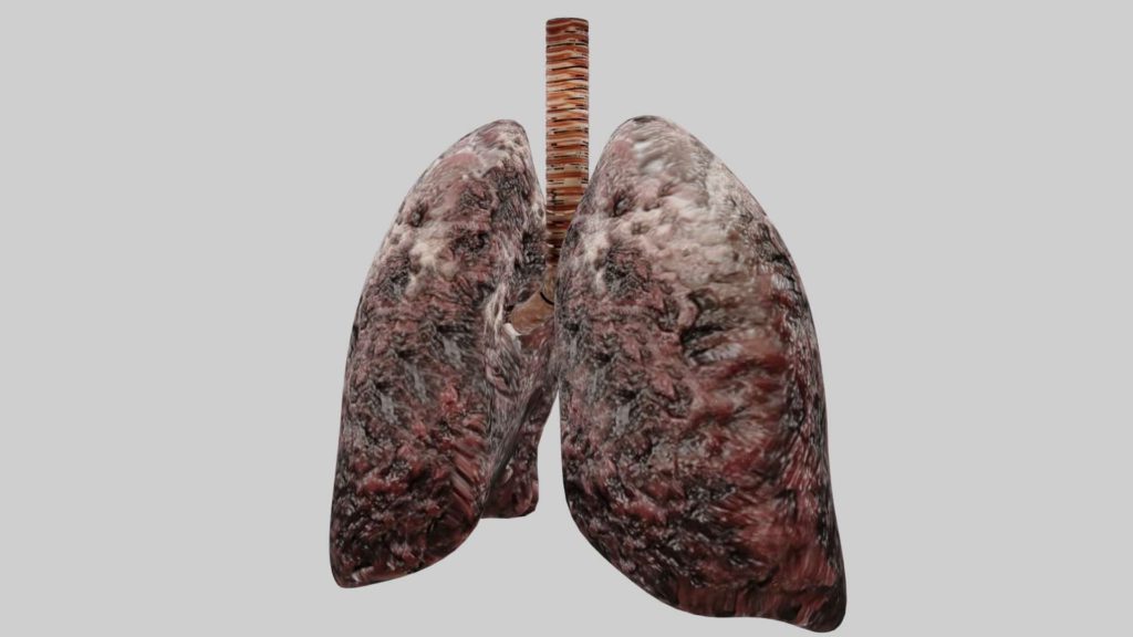 Smoker Lungs 3d Model Rigged and Low poly - Team 3d Yard