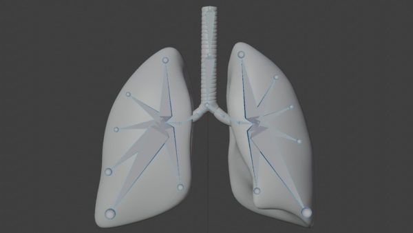 Smoker Lungs 3D Model